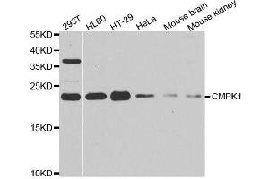 Western blot analysis of extracts of various cell lines, using CMPK1 antibody. (Cytidine Monophosphate (UMP-CMP) Kinase 1, Cytosolic (CMPK1) (AA 69-228) 抗体)
