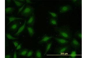 Image no. 2 for anti-Mitogen-Activated Protein Kinase-Activated Protein Kinase 2 (MAPKAPK2) (AA 302-401) antibody (ABIN598601) (MAPKAP Kinase 2 抗体  (AA 302-401))