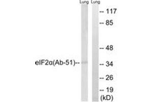 Western blot analysis of extracts from rat lung, using eIF2 alpha (Ab-51) Antibody. (EIF2A 抗体  (AA 21-70))