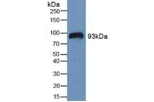Detection of HIF1a in Human Serum using Polyclonal Antibody to Hypoxia Inducible Factor 1 Alpha (HIF1a)