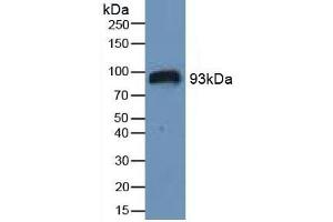 Detection of HIF1a in Human Serum using Polyclonal Antibody to Hypoxia Inducible Factor 1 Alpha (HIF1a) (HIF1A 抗体  (AA 575-826))