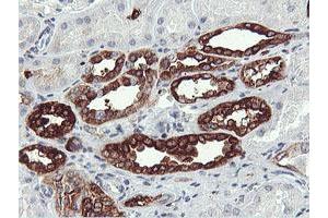 Immunohistochemical staining of paraffin-embedded Human Kidney tissue using anti-PFKP mouse monoclonal antibody. (PFKP 抗体)