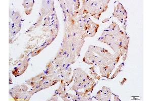 Formalin-fixed and paraffin embedded mouse heart tissue labeled with Anti-Desmin Polyclonal Antibody, Unconjugated  at 1:200, followed by conjugation to the secondary antibody and DAB staining (Desmin 抗体  (AA 261-360))