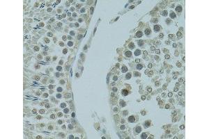 Immunohistochemistry of paraffin-embedded Rat testis using PRDM2 Polyclonal Antibody at dilution of 1:100 (40x lens). (PRDM2 抗体)