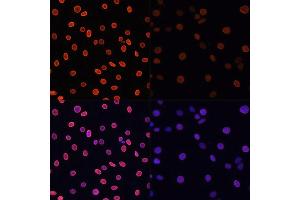 Immunofluorescence analysis of C6 cells using Acetyl-Histone H4-K91 antibody (ABIN7267748) at dilution of 1:100.