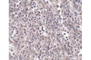 Immunohistochemistry of EBI3 in human spleen tissue with EBI3 antibody at 2. (EBI3 抗体  (Center))