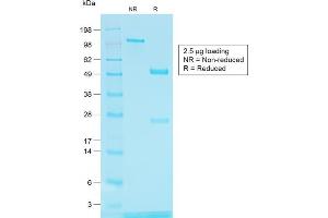 SDS-PAGE Analysis of Purified TYRP1 Rabbit Recombinant Monoclonal Antibody (TYRP1/1564R) (Tyrosinase-Related Protein 1 抗体)