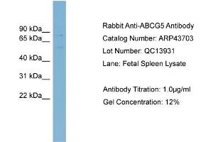 Western Blotting (WB) image for anti-ATP-Binding Cassette, Sub-Family G (WHITE), Member 5 (ABCG5) (Middle Region) antibody (ABIN2781532)