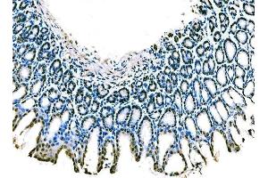 IHC analysis of KLF4 using anti-KLF4 antibody (ABIN7599343). (KLF4 抗体  (AA 1-389))