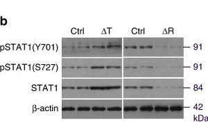 mTORC1 regulates CXCL9 in osteoblasts via STAT1. (STAT1 抗体  (pTyr701))
