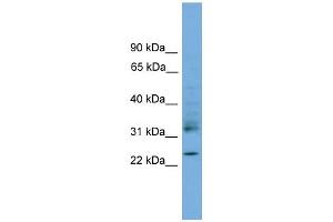 WB Suggested Anti-RHOJ Antibody Titration: 0. (RHOJ 抗体  (Middle Region))