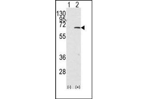 Image no. 1 for anti-Protein Inhibitor of Activated STAT, 1 (PIAS1) (C-Term) antibody (ABIN356763) (PIAS1 抗体  (C-Term))