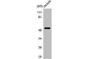 Western Blot analysis of Jurkat cells using PRP19 Polyclonal Antibody (PRP19 抗体  (Internal Region))