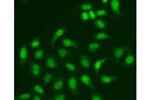 Immunofluorescence analysis of A549 cell using CETN2 antibody. (CETN2 抗体)
