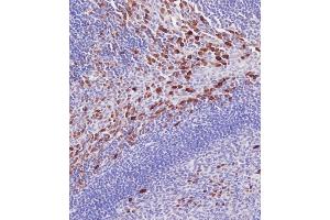 Immunohistochemical analysis of A on paraffin-embedded Human tonsil tissue. (IRAK3 抗体  (N-Term))