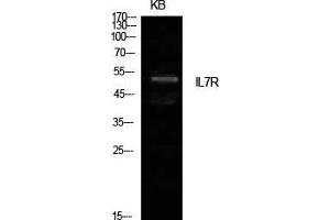 Western Blot (WB) analysis of KB cells using IL-7R Polyclonal Antibody. (IL7R 抗体  (Internal Region))