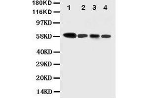 Anti-Caspase-10 antibody, Western blotting Lane 1: COLO320 Cell Lysate Lane 2: HELA Cell Lysate Lane 3: SW620 Cell Lysate Lane 4: RAJI Cell Lysate (Caspase 10 抗体  (N-Term))