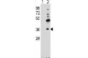 Western Blotting (WB) image for anti-Gap Junction Protein, beta 4, 30.3kDa (GJB4) antibody (ABIN2998429)