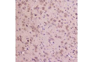IHC analysis of IGFBP2 using anti-IGFBP2 antibody (ABIN5693239).