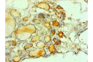 Immunohistochemical of paraffin-embedded human thyroid tissues using ABIN7162718 at dilution of 1:200 (CGRP 抗体)