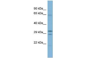 WB Suggested Anti-FAM131C Antibody Titration: 0. (FAM131C 抗体  (Middle Region))