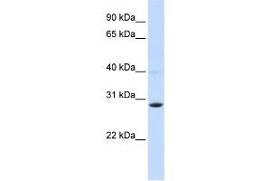 WB Suggested Anti-PGAM2 Antibody Titration:  0. (PGAM2 抗体  (Middle Region))
