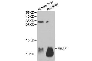 Western blot analysis of extracts of various tissues, using AHSP antibody. (aHSP 抗体)
