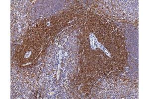 IHC analysis of Cd2 using anti-Cd2 antibody (ABIN7601386).