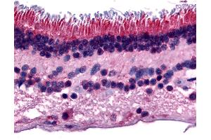 Anti-PTPRM antibody IHC of human retina. (PTPRM 抗体  (Internal Region))