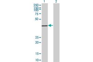 Western Blot analysis of ALS2CR7 expression in transfected 293T cell line by ALS2CR7 polyclonal antibody (A01). (Cyclin-Dependent Kinase 15 (ALS2CR7) (AA 242-347) 抗体)