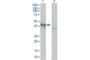 Western Blot analysis of DCX expression in transfected 293T cell line by DCX monoclonal antibody (M01), clone 1G12. (Doublecortin 抗体  (AA 1-360))