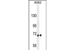 DPY19L1 抗体  (C-Term)
