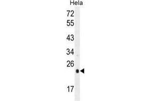 UQCRFS1 Antibody (C-term) western blot analysis in Hela cell line lysates (35 µg/lane). (UQCRFS1 (Complex III Subunit Rieske) (AA 188-217), (C-Term) 抗体)