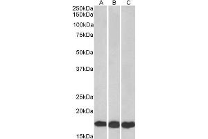 ABIN184900 (0. (UBE2L3 抗体  (C-Term))