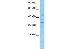 Host:  Mouse  Target Name:  RUVBL2  Sample Tissue:  Mouse Kidney  Antibody Dilution:  1ug/ml (RUVBL2 抗体  (N-Term))
