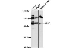 Western Blotting (WB) image for anti-Cleavage and Polyadenylation Specific Factor 7, 59kDa (CPSF7) (AA 50-240) antibody (ABIN6140675)