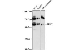 Western blot analysis of extracts of various cell lines, using CPSF7 antibody (ABIN6131022, ABIN6140675, ABIN6140676 and ABIN6218037) at 1:3000 dilution. (CPSF7 抗体  (AA 50-240))