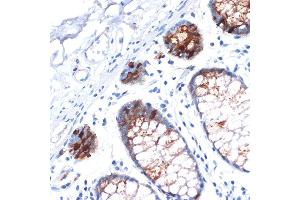 Immunohistochemistry of paraffin-embedded human colon using IGFBP2 Rabbit mAb (ABIN7267907) at dilution of 1:100 (40x lens).