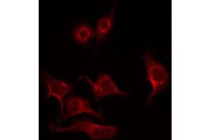 ABIN6269096 staining HeLa by IF/ICC. (PKC beta 抗体  (C-Term))
