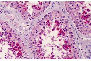 Immunohistochemistry (Formalin-fixed Paraffin-embedded Sections) (IHC (fp)) image for anti-Solute Carrier Family 35 (UDP-Glucuronic Acid/UDP-N-Acetylgalactosamine Dual Transporter), Member D1 (SLC35D1) (C-Term) antibody (ABIN605061)