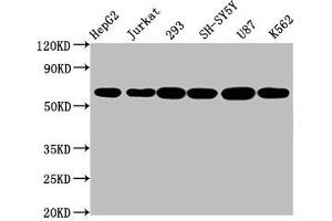 Western Blot Positive WB detected in: HepG2 whole cell lysate, Jurkat whole cell lysate, 293 whole cell lysate, SH-SY5Y whole cell lysate, U87 whole cell lysate, K562 whole cell lysate All lanes: CYP19A1 antibody at 2. (Recombinant Aromatase 抗体)