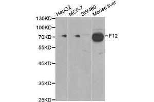 Western blot analysis of extracts of various cell lines, using F12 antibody. (F12 抗体)