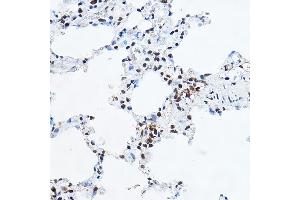 Immunohistochemistry of paraffin-embedded rat lung using YE Rabbit pAb (ABIN6130808, ABIN6150331, ABIN6150332 and ABIN6221925) at dilution of 1:100 (40x lens). (GAS41 抗体  (AA 1-227))