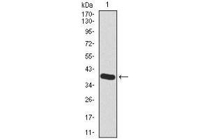 Western Blotting (WB) image for anti-Hyaluronan Synthase 2 (HAS2) (AA 67-170) antibody (ABIN1098124)