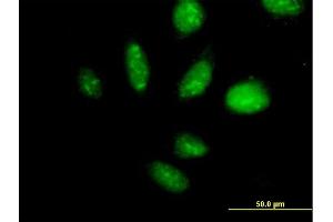 Immunofluorescence of purified MaxPab antibody to TAF1B on HeLa cell. (TAF1B 抗体  (AA 1-588))