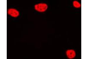 Immunofluorescent analysis of TCEB3C staining in Jurkat cells. (TCEB3C 抗体  (C-Term))