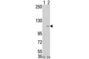 Western blot analysis of LSD1 antibody and 293 cell lysate (2 ug/lane) either nontransfected (Lane 1) or transiently transfected with the AOF2 gene (2). (LSD1 抗体  (AA 457-490))