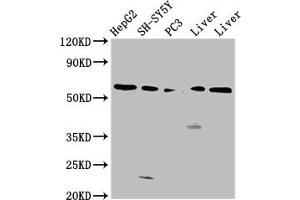 Western Blot Positive WB detected in: HepG2 whole cell lysate, SH-SY5Y whole cell lysate, PC-3 whole cell lysate, Rat liver tissue, Mouse liver tissue All lanes: UGT1A1 antibody at 4. (UGT1A1 抗体  (AA 395-482))