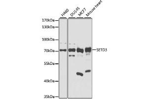 Western blot analysis of extracts of various cell lines, using SETD3 antibody. (SETD3 抗体)