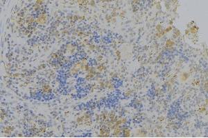 ABIN6276336 at 1/100 staining Human lymph node tissue by IHC-P. (Olfactomedin 1 抗体)